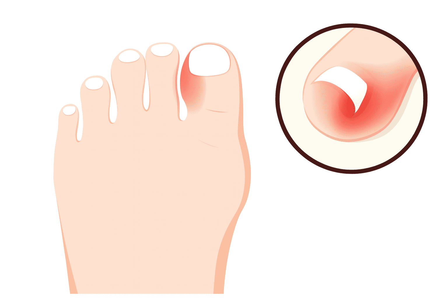 toenail problems foot condition